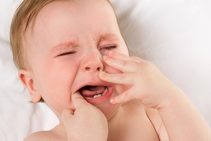 Nhiệt miệng ở trẻ em thường có những biểu hiện gì?