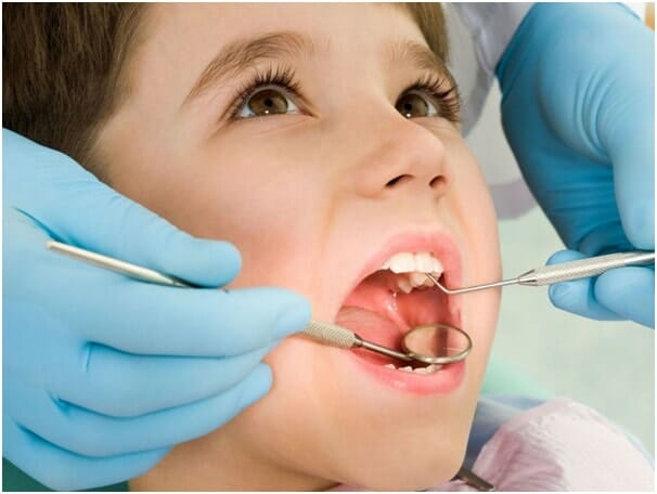 Cách điều trị sâu răng phụ thuộc vào mức độ tình trạng nặng nhẹ 